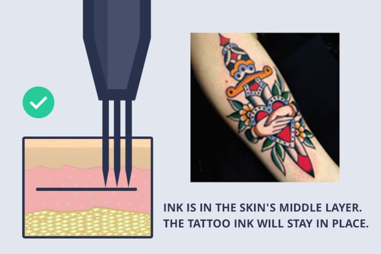 Depth of tattoo ink in skin