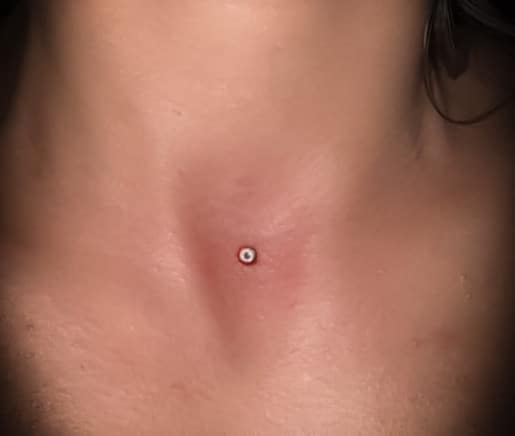 body and surface piercings